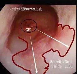 微信图片_20181116095244.jpg