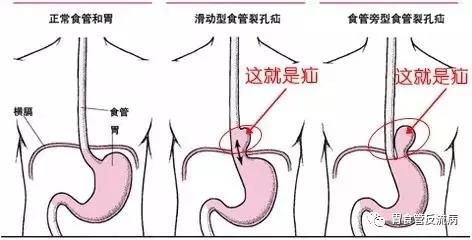 微信图片_20181116095247.jpg