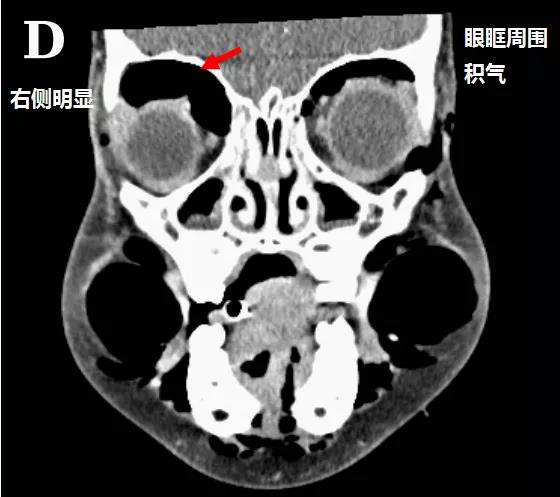 微信图片_20200425210553.jpg 微信图片_20200425210553.jpg